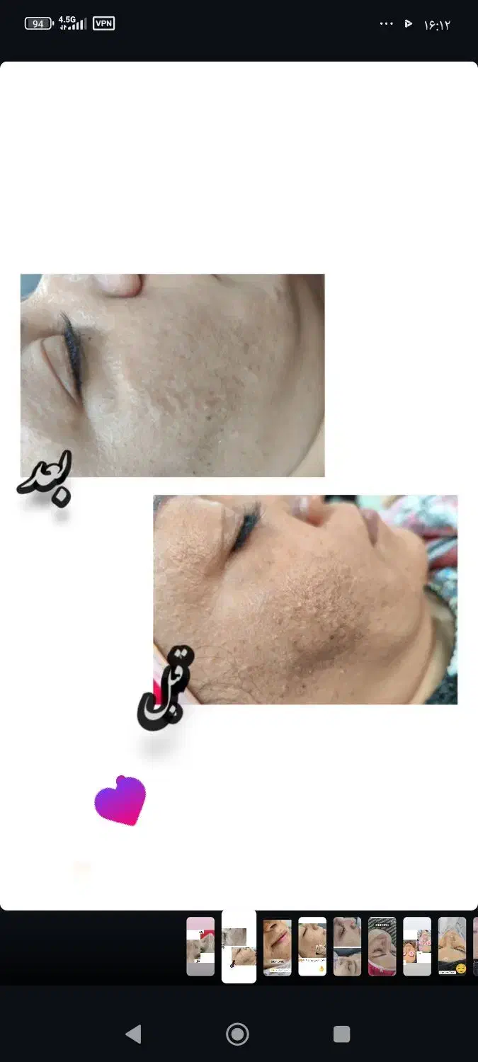 فیشیال|خدمات آرایشگری و زیبایی|رفسنجان, |دیوار