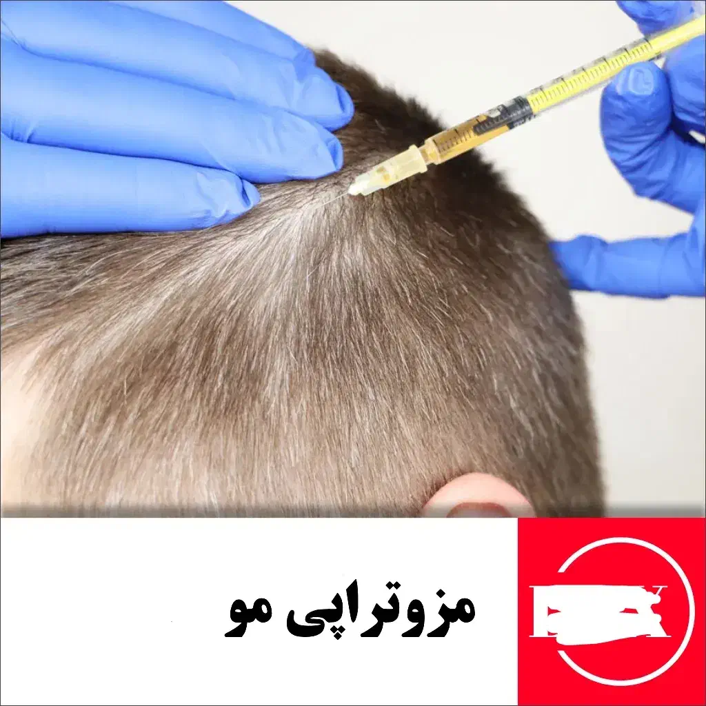انجام خدمات مزوتراپی و پی آر پی مو و ابرو|خدمات آرایشگری و زیبایی|پارسآباد, |دیوار