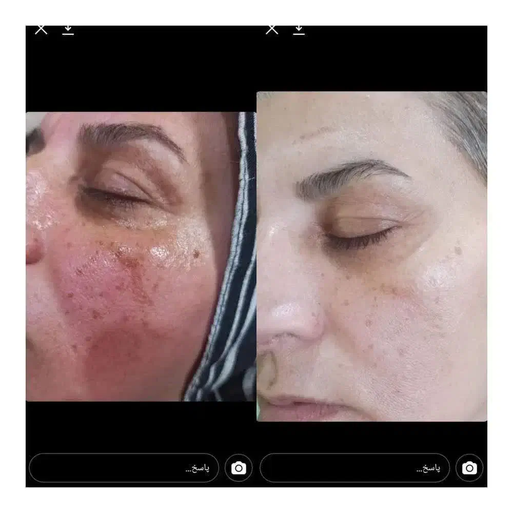 پوست و مو|آرایشی، بهداشتی، درمانی|زبرخان, |دیوار