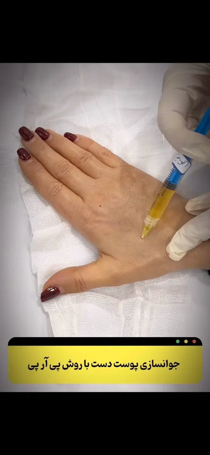 معجزه پوست و مو با پی ار پی|خدمات آرایشگری و زیبایی|خرمشهر, |دیوار