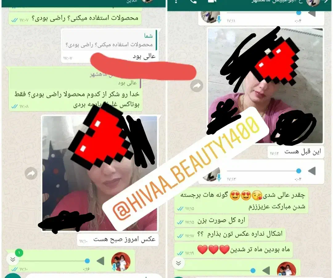 کرم بوتاکس و چاقی صورت لارا|آرایشی، بهداشتی، درمانی|مرودشت, ثبت احوال|دیوار