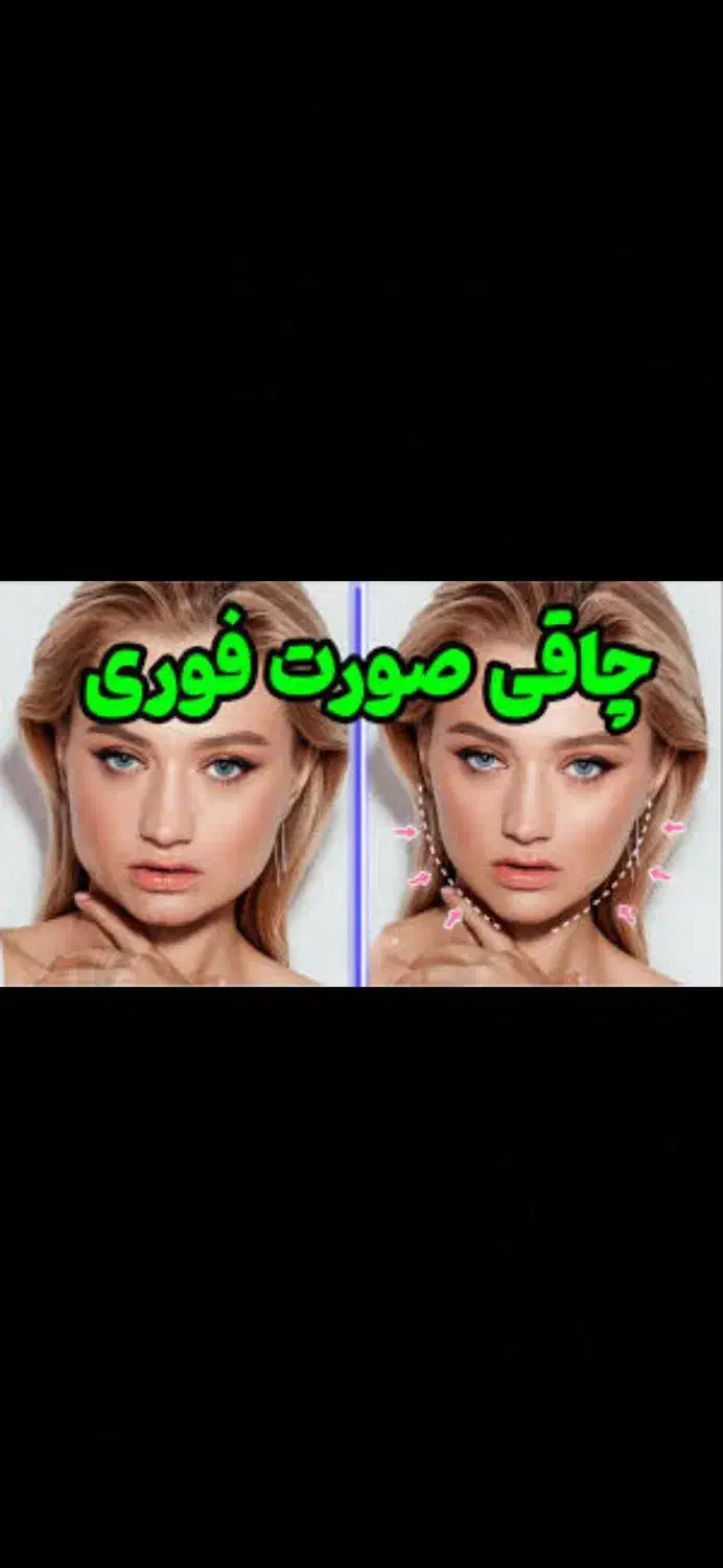 پکیج های چاقی و لاغری.صورت بدن.گیاهی|آرایشی، بهداشتی، درمانی|فولادشهر, فولادشهر|دیوار