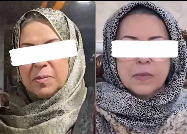 کرم ضدلک و سفیدکننده قوی و‌جوانساز صورت|آرایشی، بهداشتی، درمانی|فردیس, مجموعه کارخانه جات مپنا|دیوار