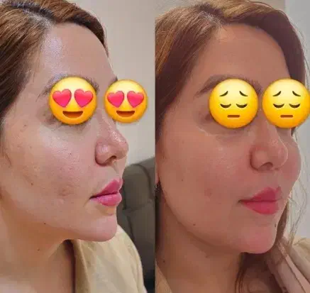 لیدر زیبایی ژل و بوتاکس و کاشت مو|استخدام درمانی، زیبایی، بهداشتی|کرمانشاه, |دیوار