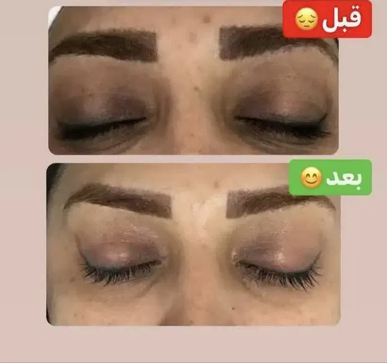 زیبایی و سلامتی پوست ومو|آرایشی، بهداشتی، درمانی|بابل, |دیوار