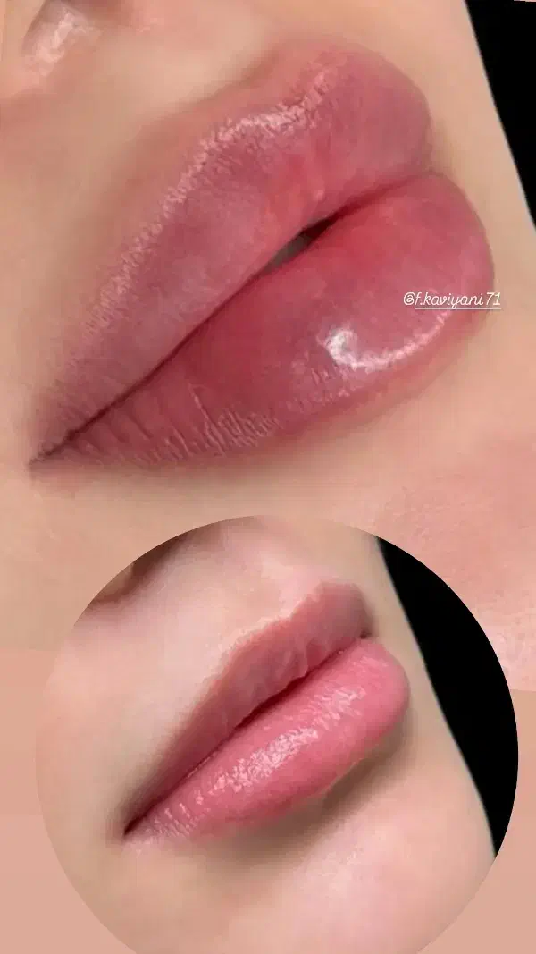 ژل بوتاکس فیلر پی ارپی مزوتراپی خال زگیل کک ومک|خدمات آرایشگری و زیبایی|شیراز, رحمت‌آباد|دیوار