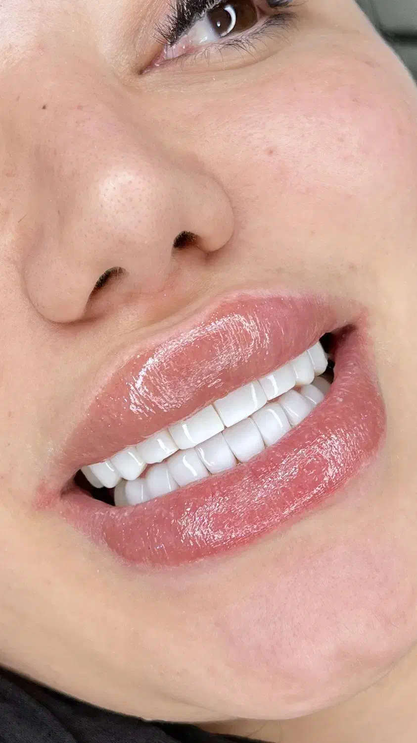 مدل کامپوزیت دندان|خدمات آرایشگری و زیبایی|تهران, هاشمی|دیوار