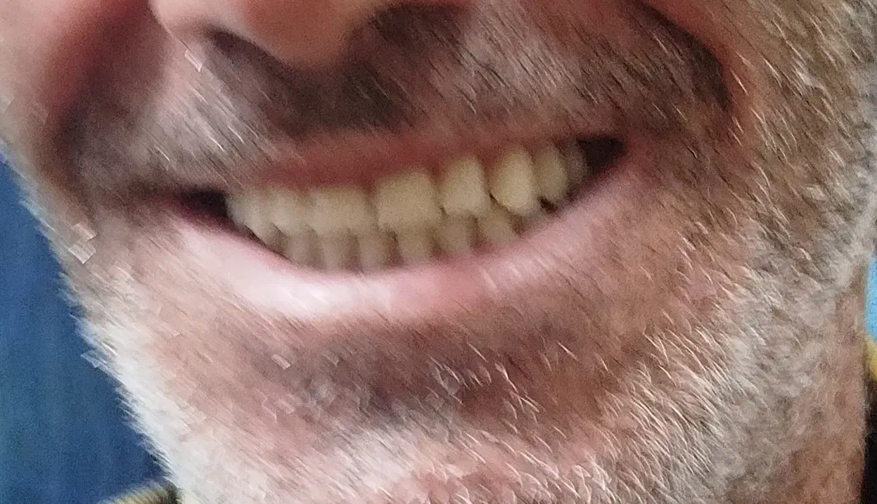 خدمات دندانپزشکی ودندانسازی ماهر|پزشکی|اصفهان, قلعه طبره|دیوار