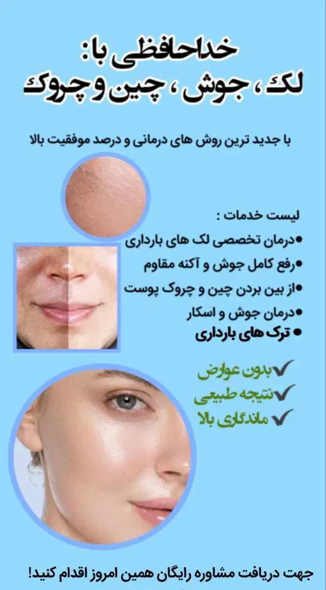 درمان عوارض پوست و مو|آرایشی، بهداشتی، درمانی|رشت, حمیدیان|دیوار