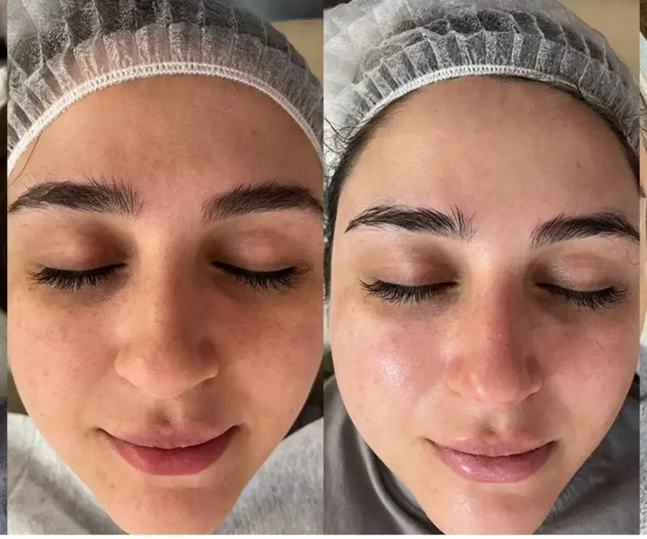 پاکسازی پوست|خدمات آرایشگری و زیبایی|سهند, |دیوار