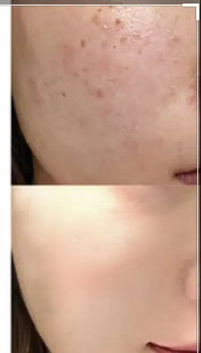 فرمول کرم سفیدکننده قوی اصل اماراتی|آرایشی، بهداشتی، درمانی|سراوان, |دیوار