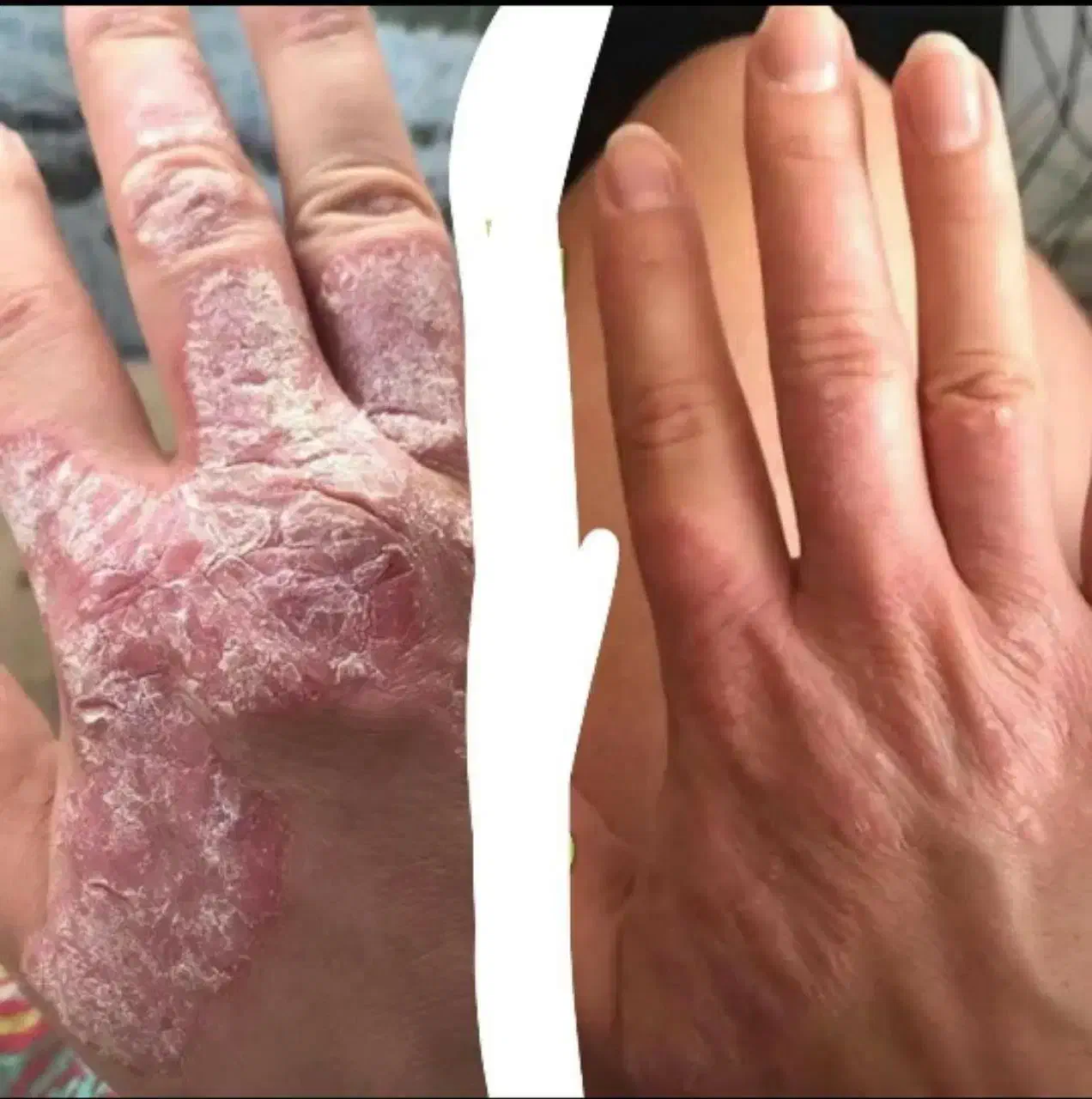 طب سنتی|آرایشی، بهداشتی، درمانی|لردگان, |دیوار