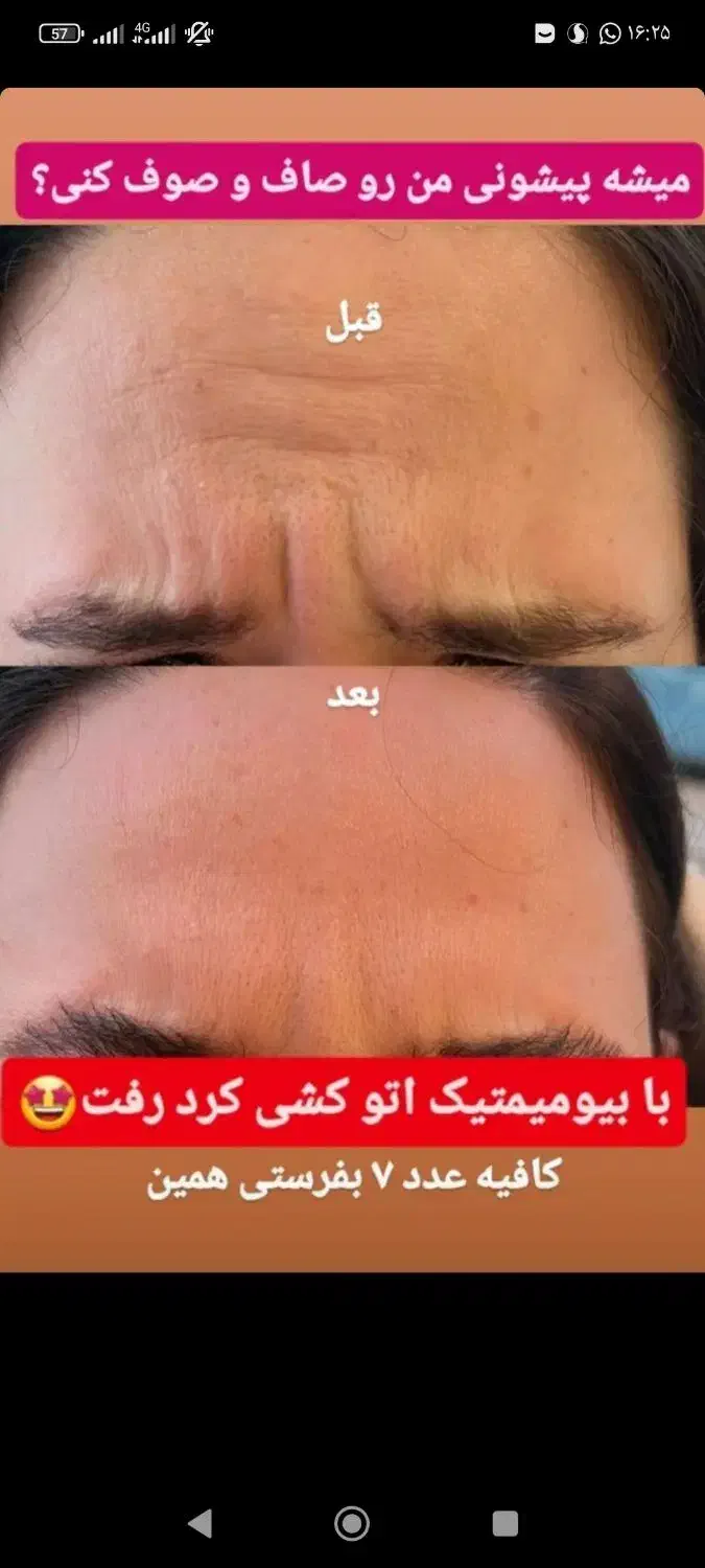 چین و چروک گاتیو|آرایشی، بهداشتی، درمانی|قم, آذر (نکویی)|دیوار