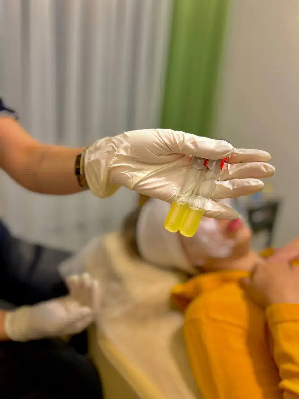 پی آرپی و مزوتراپی|خدمات آرایشگری و زیبایی|مشهد, نیروی هوایی|دیوار