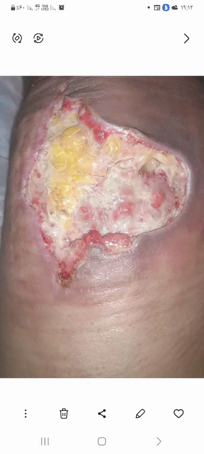 تزریقات وپانسمان در منزل|خدمات آرایشگری و زیبایی|نجفآباد, قدس|دیوار