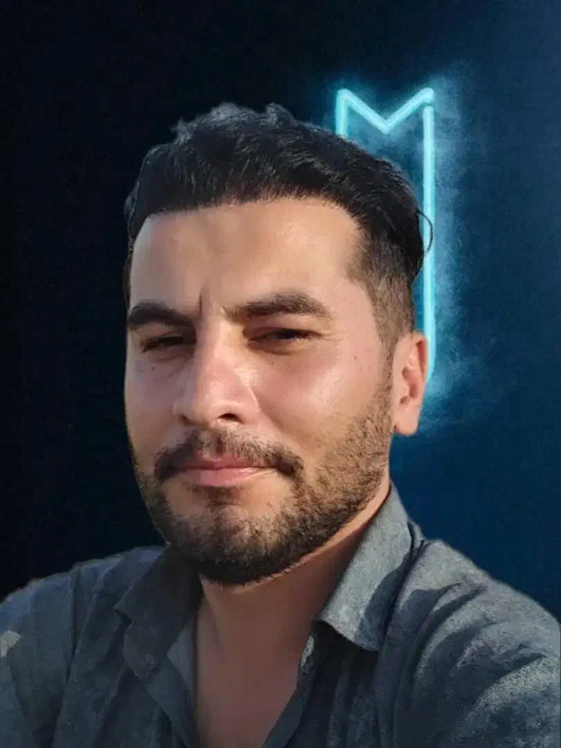 کاشت مو و ابرو با جدیدترین متدهای روز|خدمات آرایشگری و زیبایی|تبریز, |دیوار