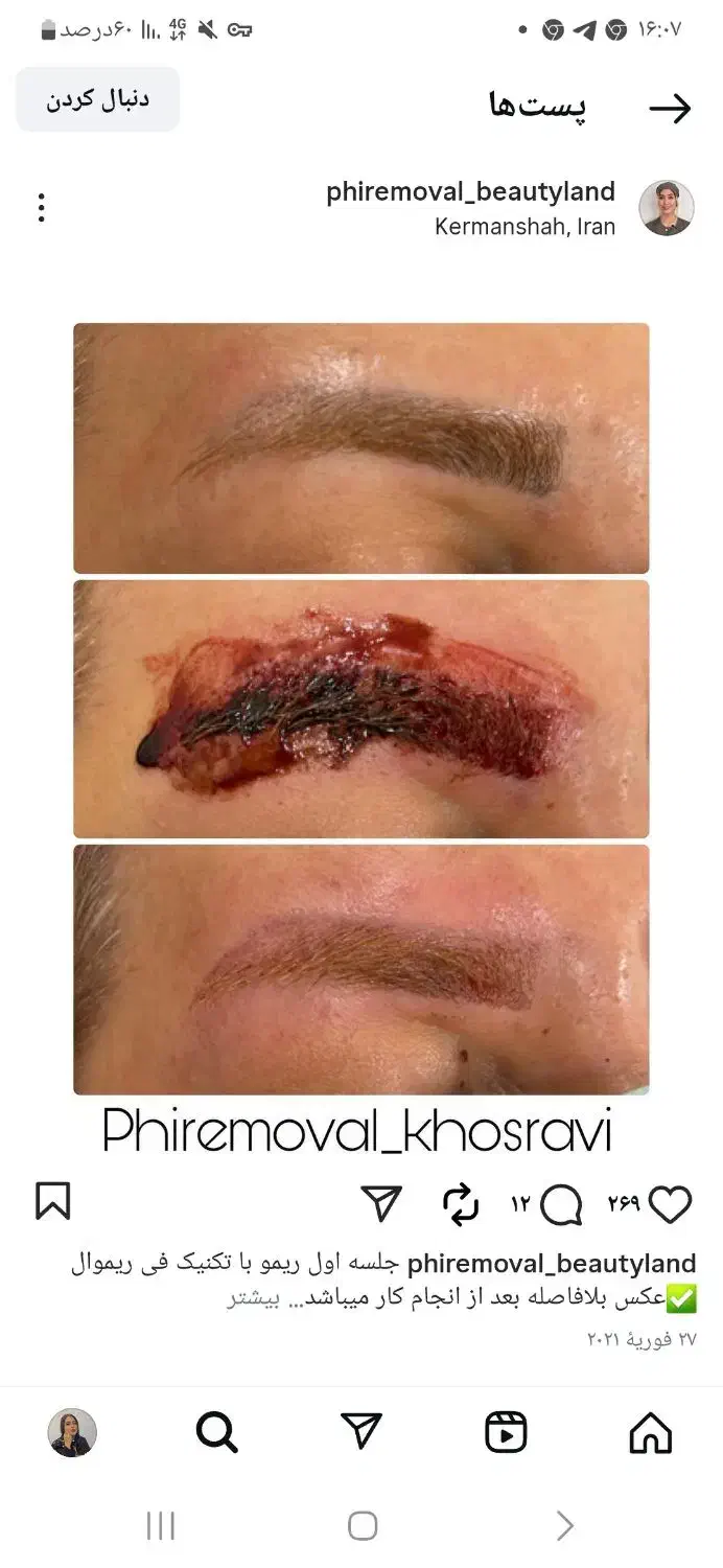 ریموتخصصی ابرو|خدمات آرایشگری و زیبایی|اندیشه, اندیشه فاز ۲|دیوار