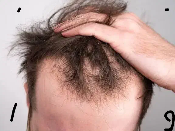 راهنمایی ریزش مو|فعالیت داوطلبانه|اصفهان, جلفا|دیوار