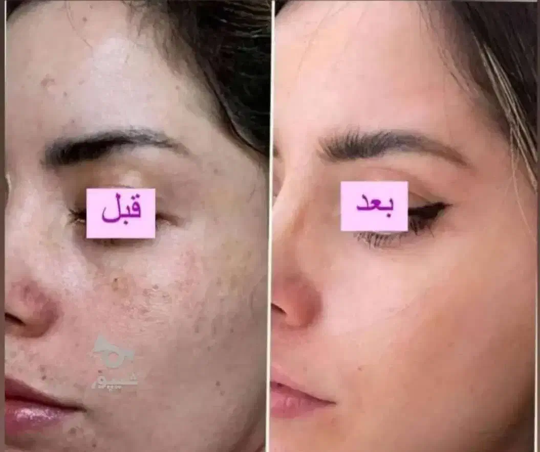 کرم وی آی پی اصل|آرایشی، بهداشتی، درمانی|امیدیه, |دیوار