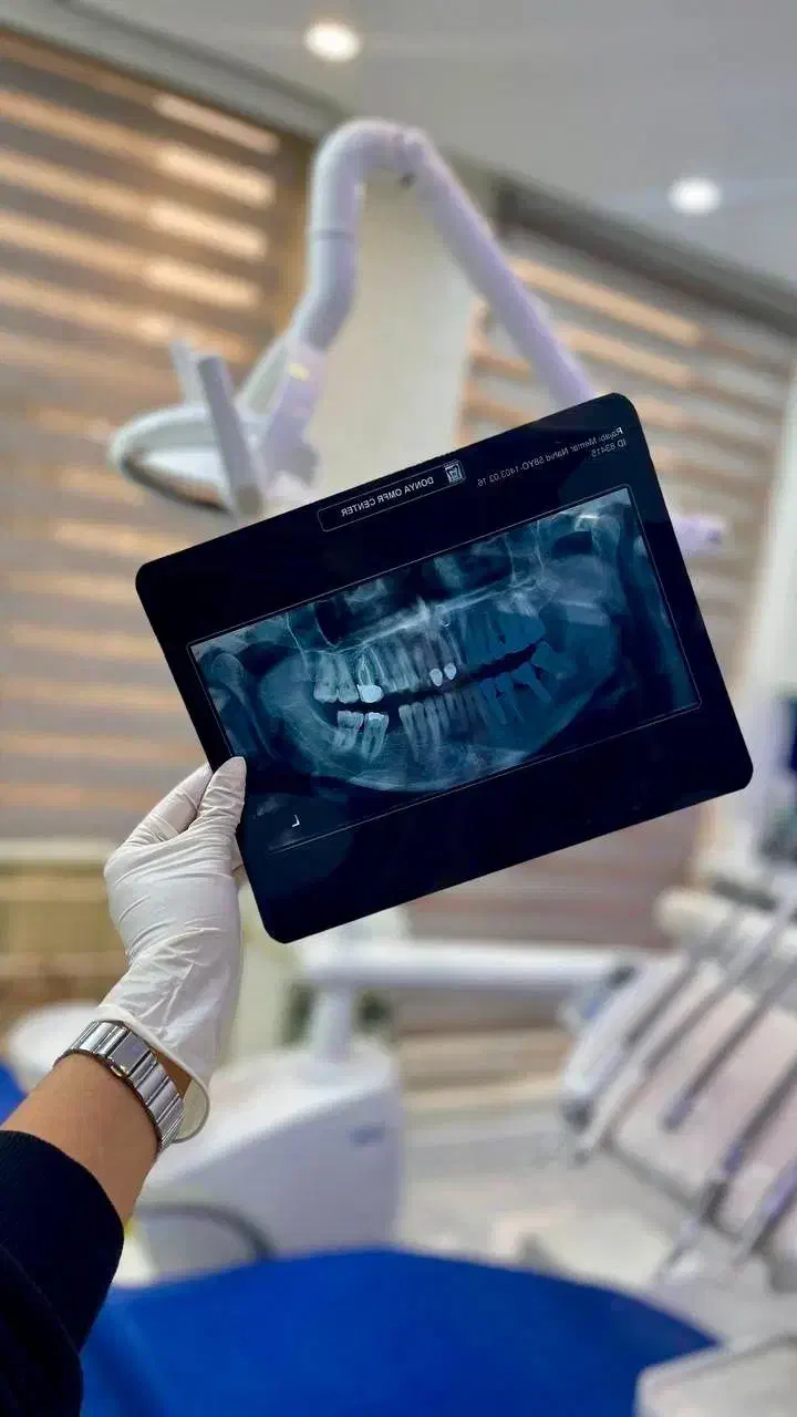 خدمات دندانپزشکی ترمیم و درمان ریشه، زیبایی،اطفال|خدمات آرایشگری و زیبایی|شهرکرد, |دیوار