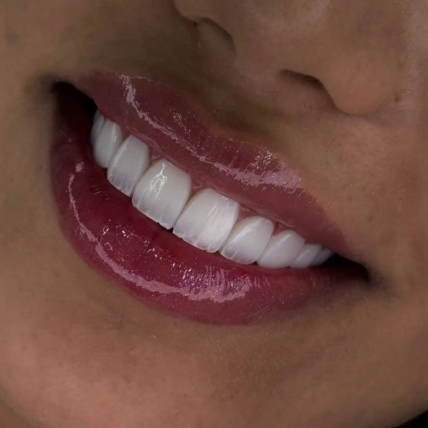 منشی خانم جهت کلینیک درمانگاه|استخدام درمانی، زیبایی، بهداشتی|تهران, جمالزاده|دیوار