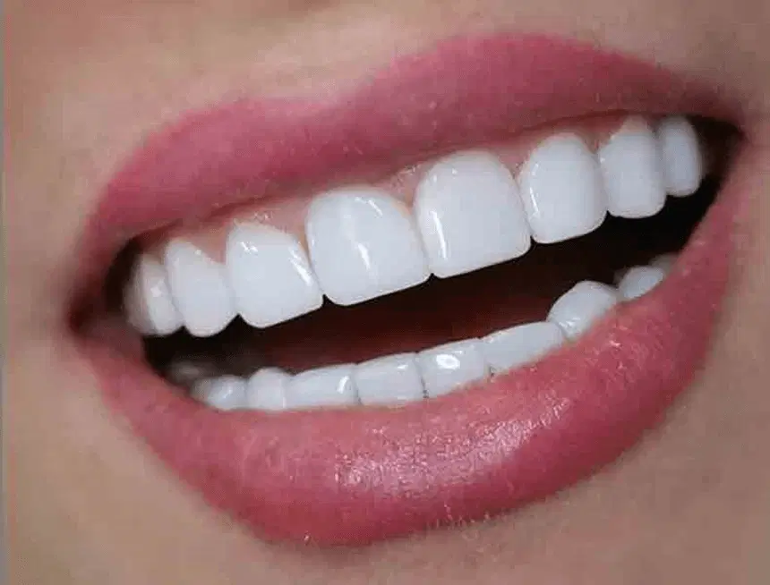 آفر ویژه دندانپزشکی آخر فصل ایمپلنت پر کردن|خدمات زیبایی و سلامت|اهواز, کیان اباد|دیوار