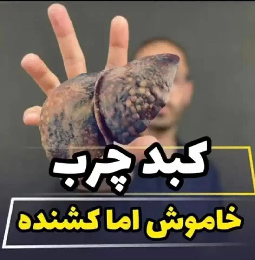 قاتل کبد چرب|آرایشی، بهداشتی، درمانی|تاکستان, |دیوار