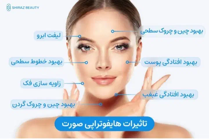 هایفوتراپی و آر اف ۷بعدی اولترا|خدمات آرایشگری و زیبایی|قم, زینبیه|دیوار