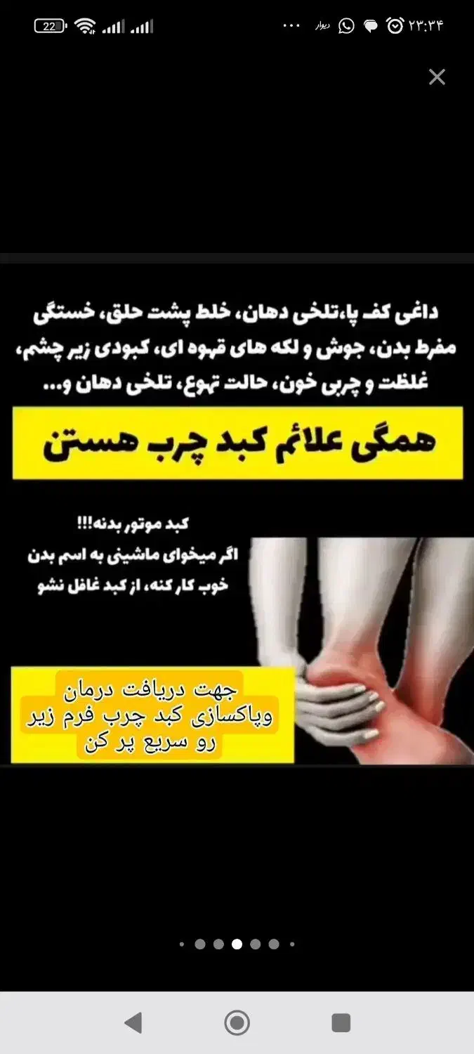 ۴۷٪ مردم بیرجند در خطر کبد چرب|خدمات آرایشگری و زیبایی|بیرجند, |دیوار