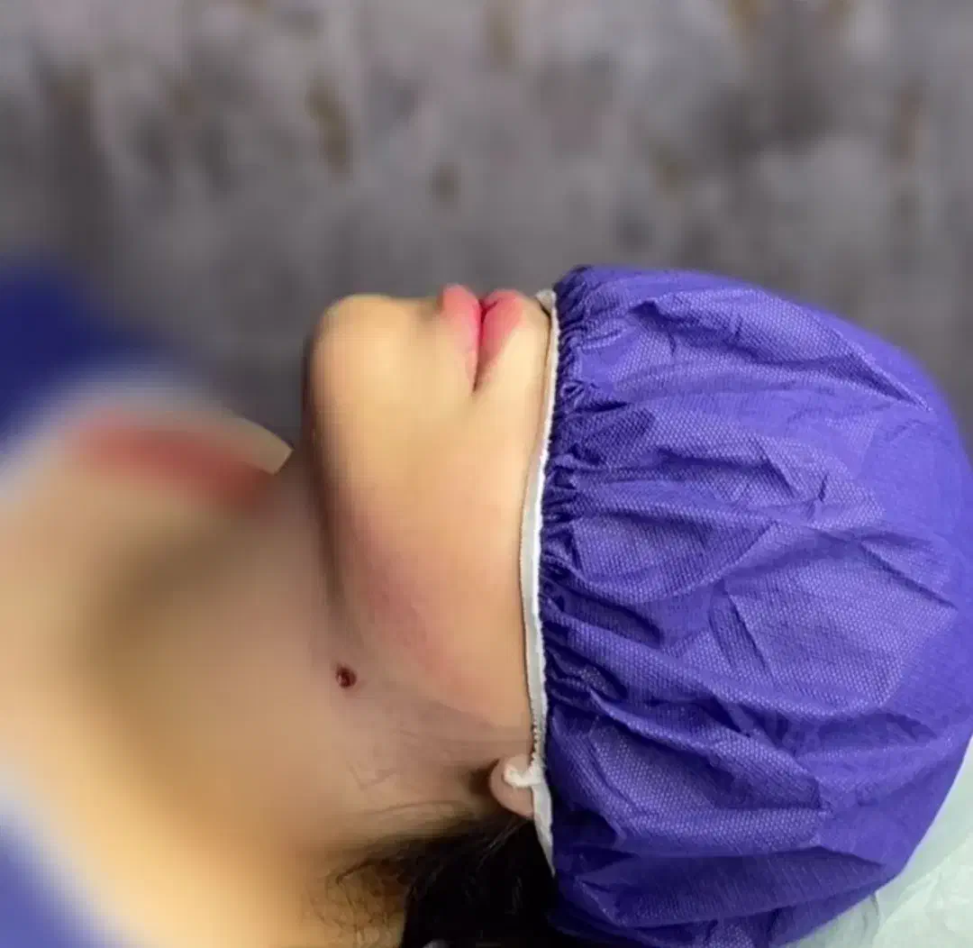 ساکشن غبغب|خدمات آرایشگری و زیبایی|یاسوج, |دیوار