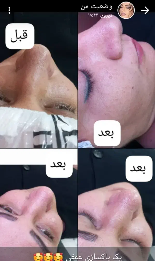 سالن زیبایی آی نیل با قیمت منصفانه|خدمات آرایشگری و زیبایی|خرمآباد, |دیوار