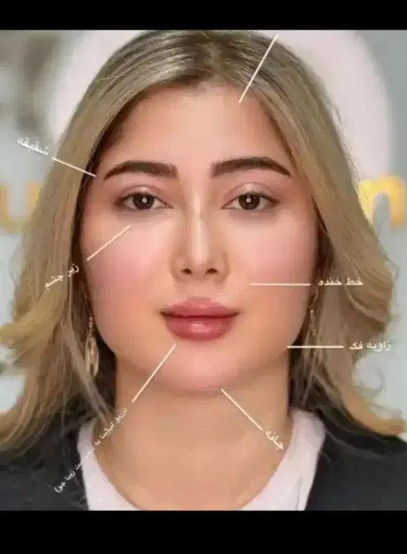 بوتاکس|خدمات آرایشگری و زیبایی|ساوه, |دیوار