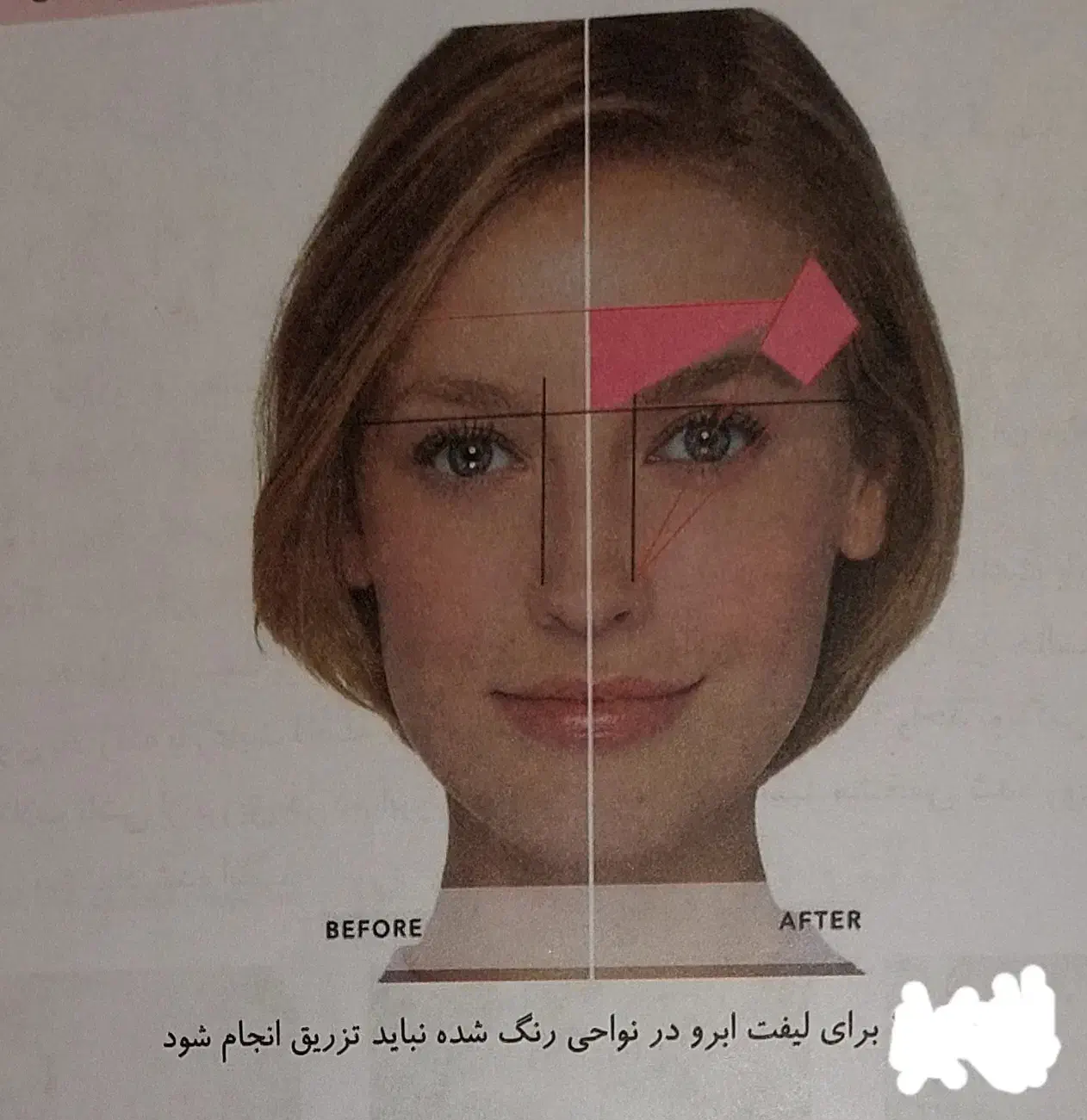 آموزش تزریق بوتاکس، فیلر، مزوتراپی|خدمات آموزشی|تهران, قیطریه|دیوار