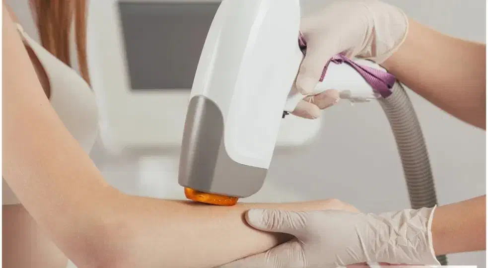 لیزر مو تخصصی و تضمینی|خدمات آرایشگری و زیبایی|سیرجان, |دیوار