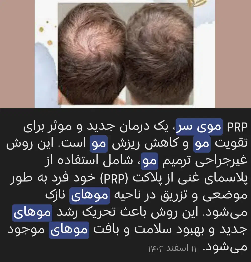 جشنواره خدمات ژل فقط 550و بوتاکس750|خدمات آرایشگری و زیبایی|فولادشهر, C3|دیوار