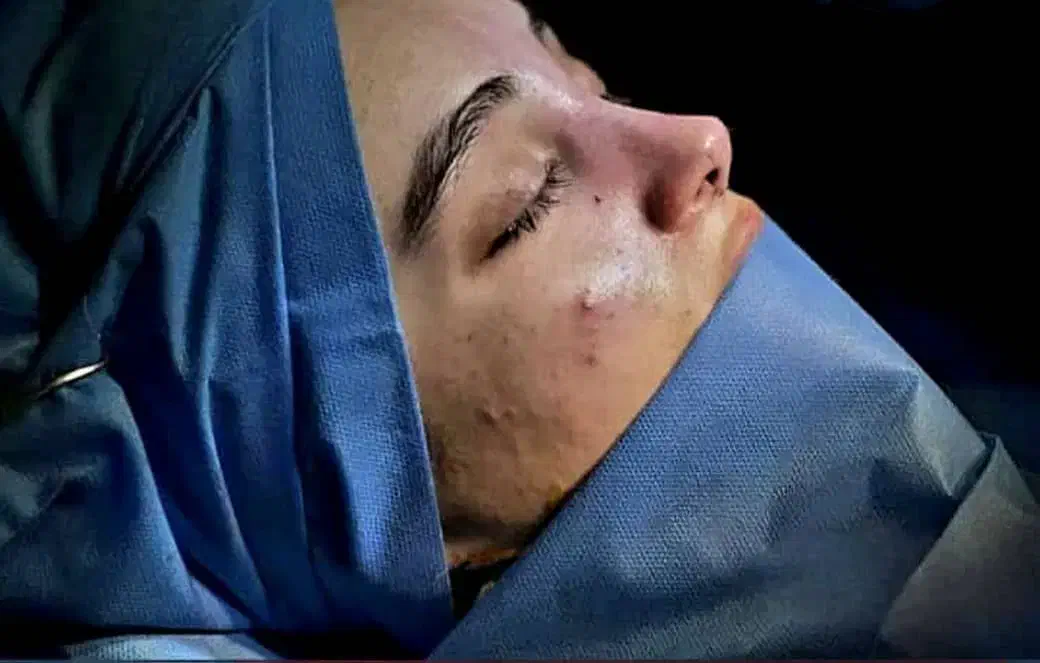 عمل بینی|خدمات آرایشگری و زیبایی|ایذه, |دیوار