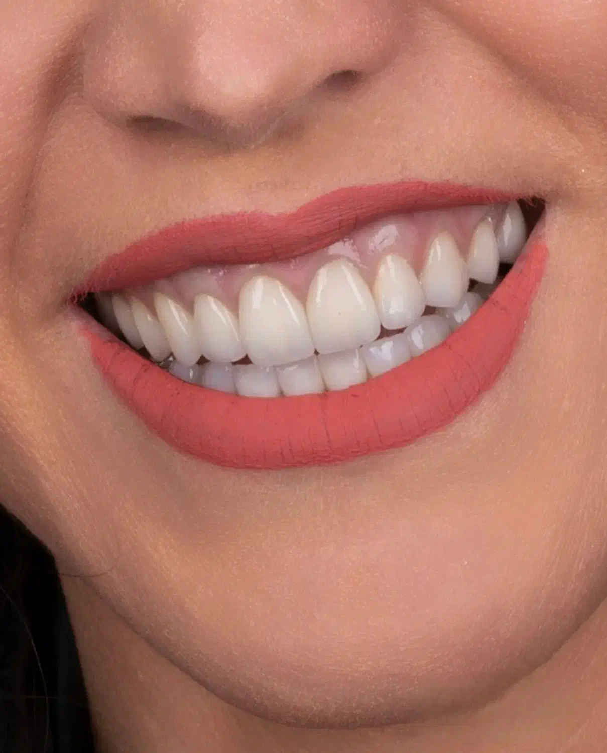 دندانپزشکی تخصصی و تضمینی|خدمات آرایشگری و زیبایی|کرمانشاه, |دیوار