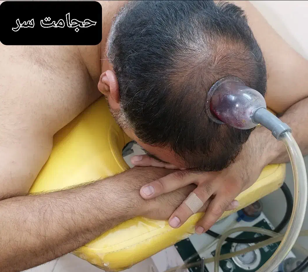 خدمات پرستاری وطب سنتی|خدمات آرایشگری و زیبایی|خوی, |دیوار