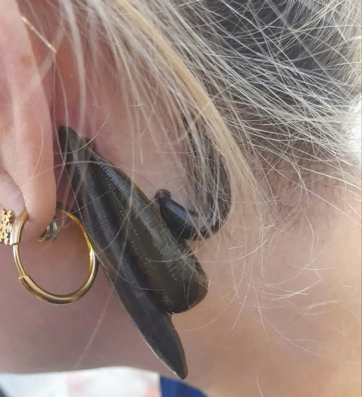 انواع حجامت ، زالو درمانی ، بادکش|خدمات آرایشگری و زیبایی|پرند, فاز ۵|دیوار