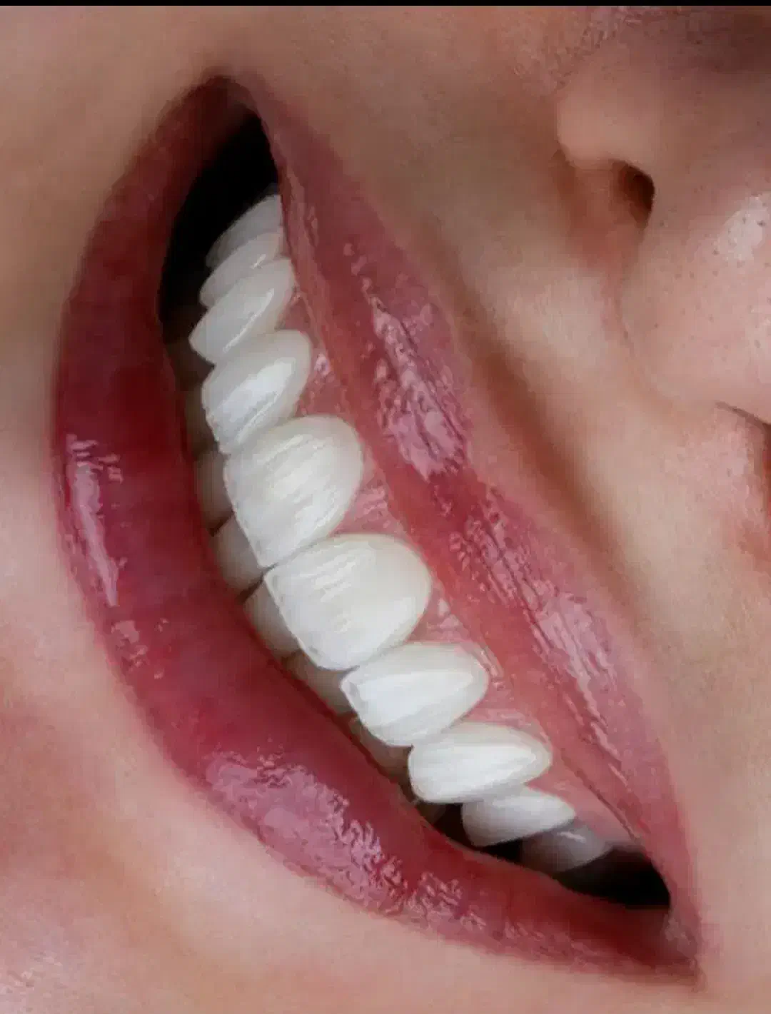 دندون پزشکی|خدمات آرایشگری و زیبایی|خرم‌آباد, |دیوار