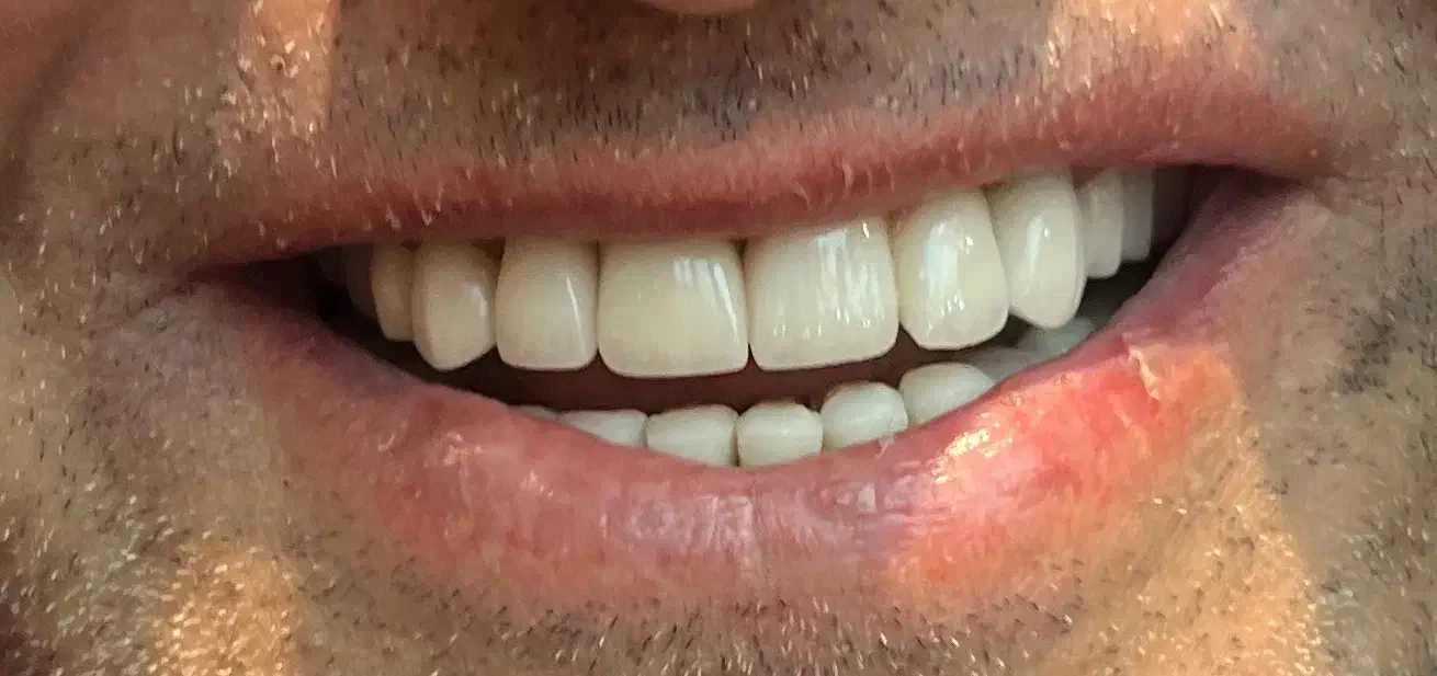 نیاز به منشی و‌ پذیرش مطب دندانپزشکی|استخدام درمانی، زیبایی، بهداشتی|تهران, جردن|دیوار