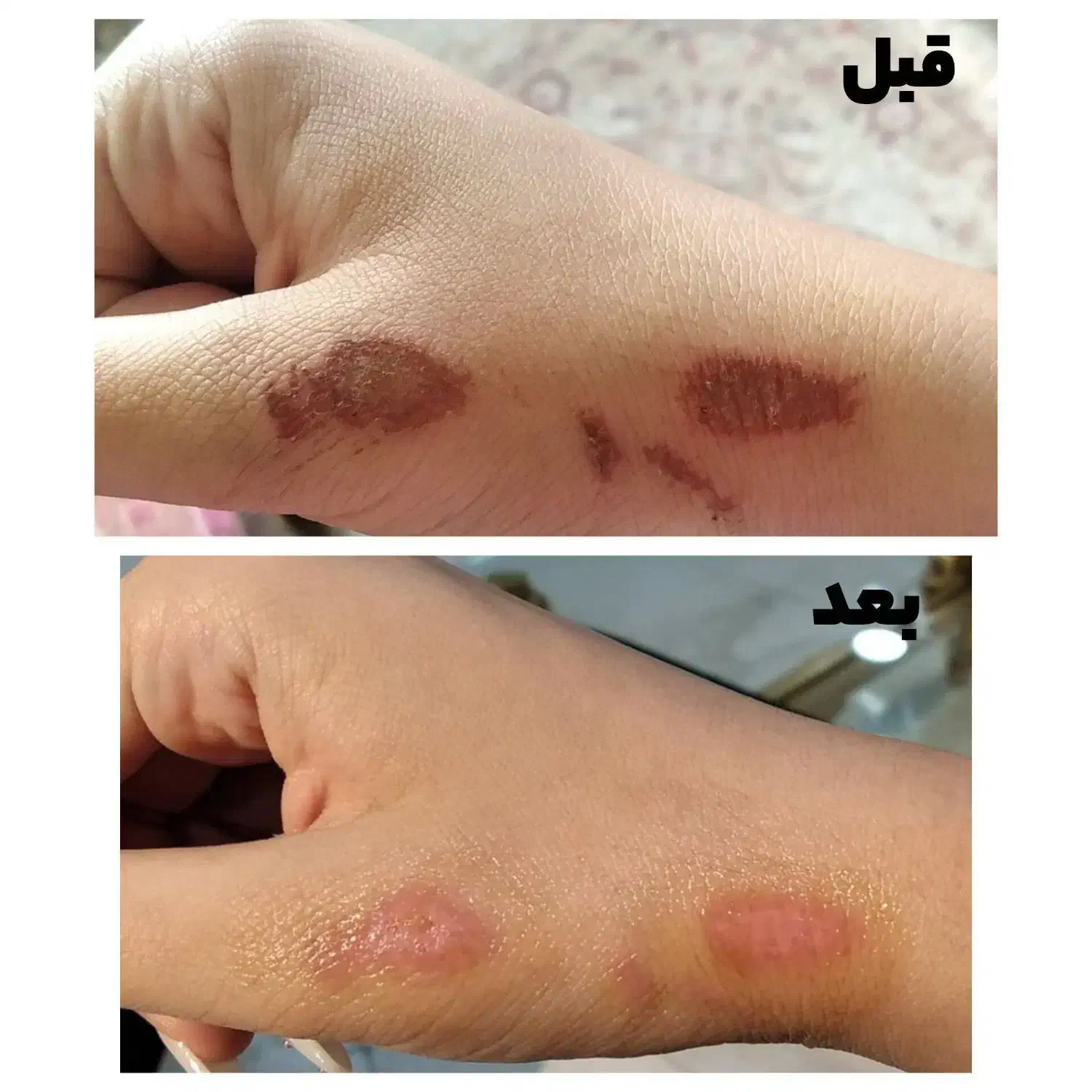 درمان بیماری هاباطب سنتی واصلاح مزاج|خدمات آرایشگری و زیبایی|بروجن, |دیوار