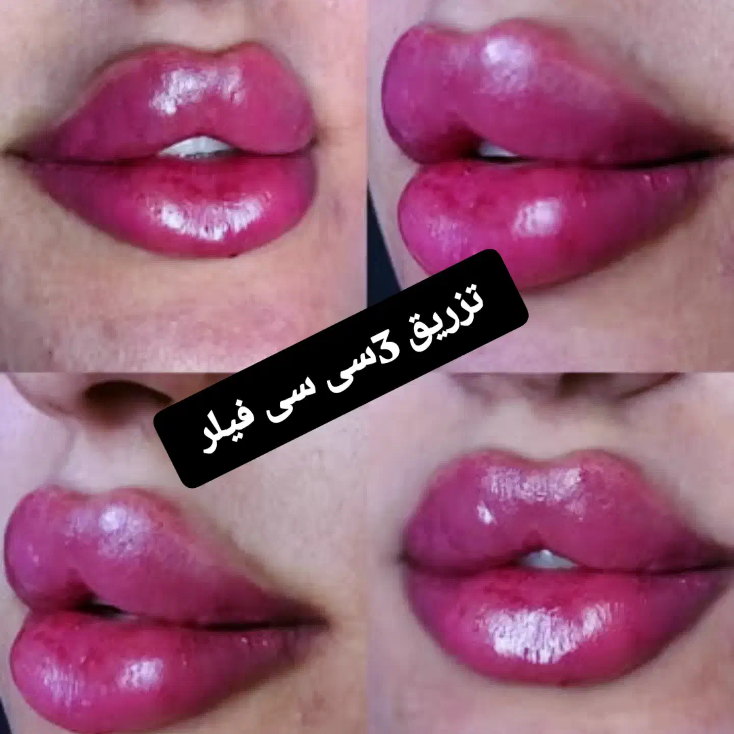 جشنواره خدمات حرفه ای درمان پوست و مو|خدمات آرایشگری و زیبایی|بستان آباد, |دیوار