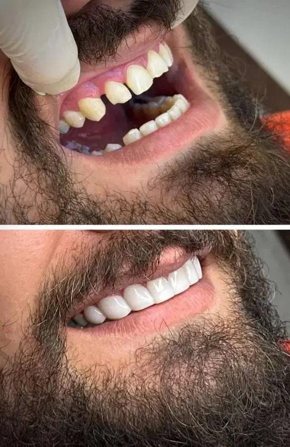 خدمات دندان پزشکی|خدمات آرایشگری و زیبایی|بروجرد, |دیوار