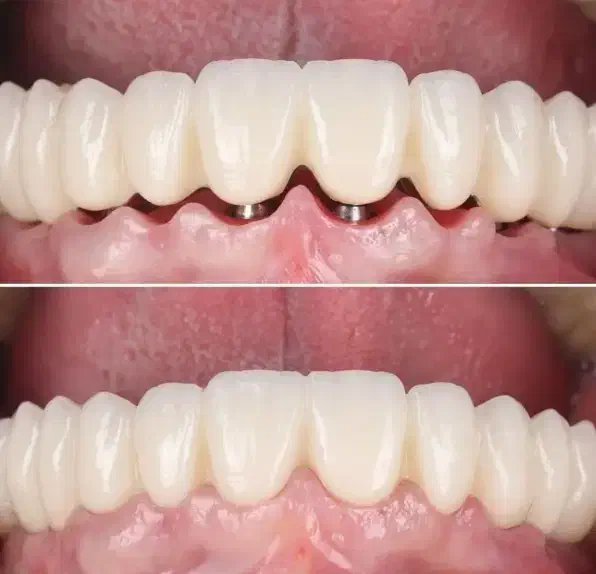 جشنواره کلیه خدمات دندانپزشکی با اقساط ۱۵ ماهه|خدمات آرایشگری و زیبایی|تبریز, |دیوار