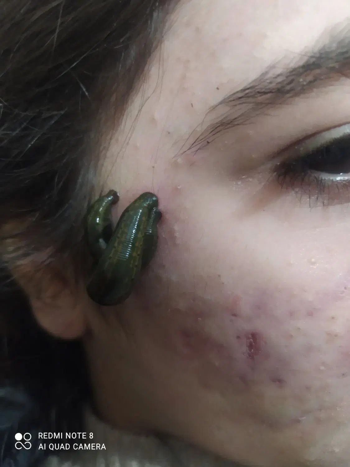 حجامت،زالودرمانی،اصلاح ستون فقرات ودیسک کمر|خدمات آرایشگری و زیبایی|خرم‌آباد, |دیوار