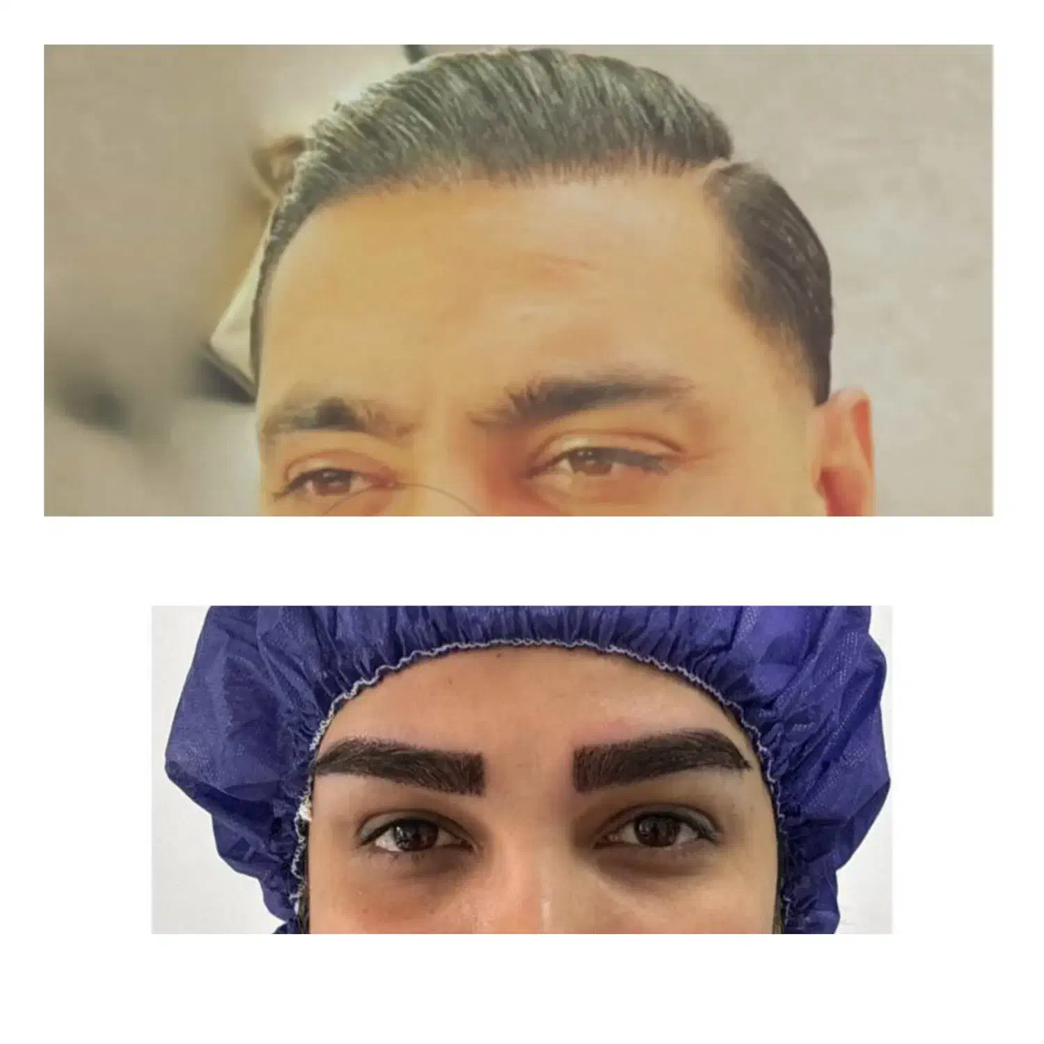 جشنواره ویژه کاشت مو و ابرو|خدمات آرایشگری و زیبایی|رشت, بوسار|دیوار