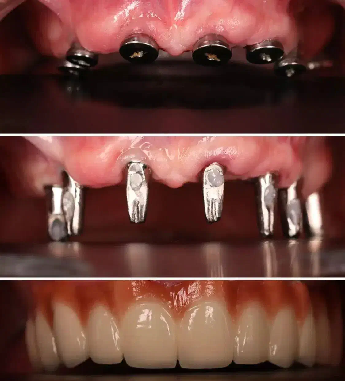 شرایط ویژه جشنواره دندانپزشکی ایمپلنت اوردنچر روکش|خدمات آرایشگری و زیبایی|تبریز, |دیوار