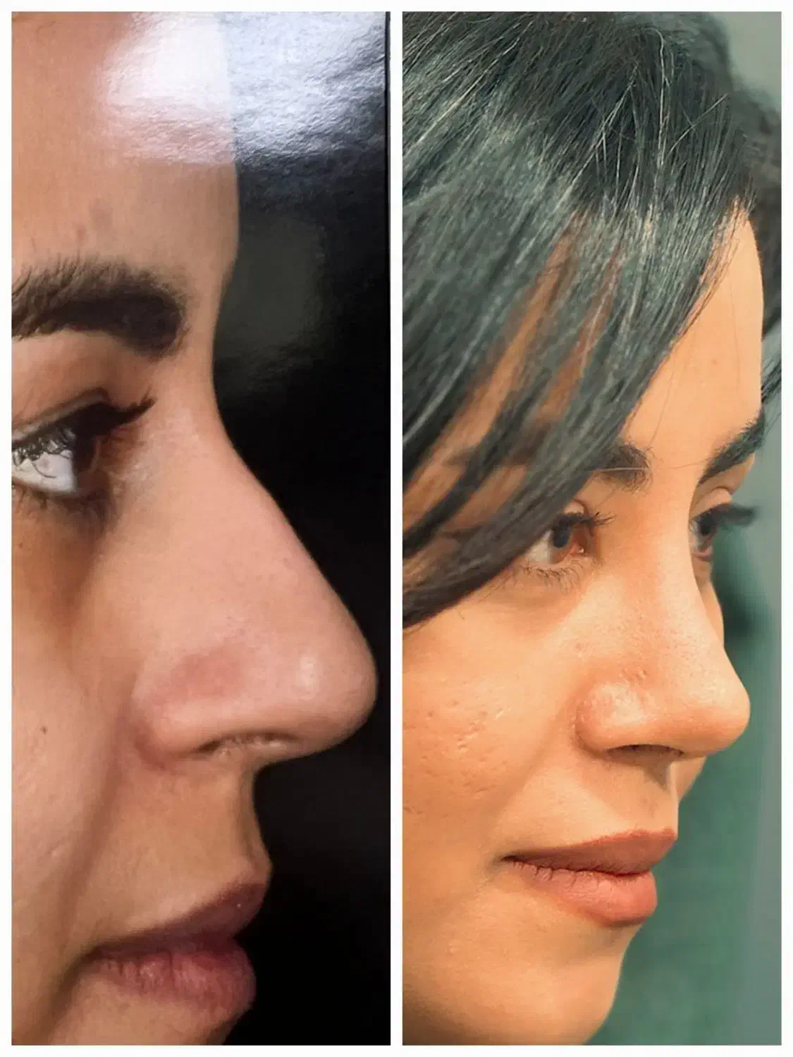 قرعه کشی صد میلیون تومنی عمل بینی|خدمات آرایشگری و زیبایی|شیراز, ستارخان|دیوار