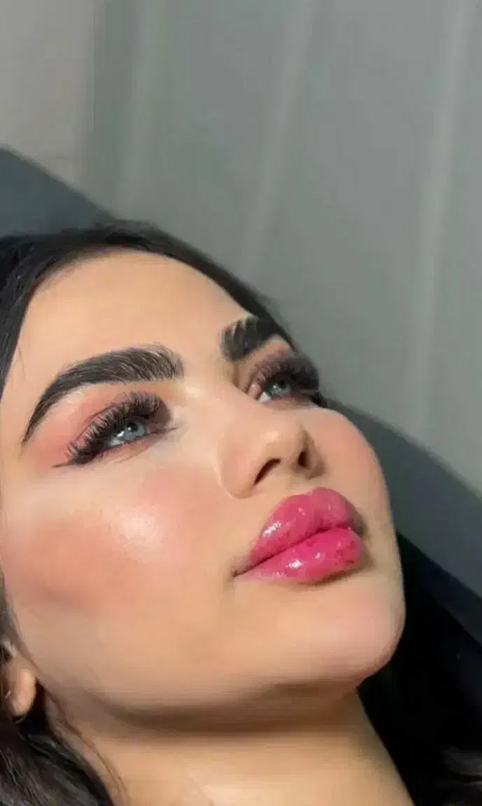 آف بلک فرایدی تزریق ژل بوتاکس فیلر ریمو تتو...|خدمات آرایشگری و زیبایی|علیآباد کتول, |دیوار